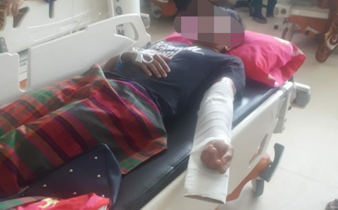 Human Error kembali jadi faktor penyebab tabrakan, 2 Pemotor alami luka & patah tulang.